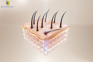 Dịch vụ triệt lông vĩnh viễn tại Thẩm Mỹ Keangnam Sóc Sơn