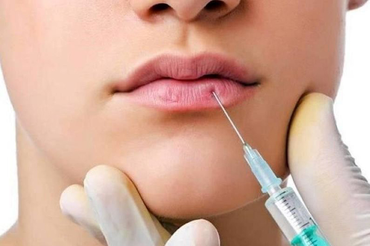 Tiêm tan filler là gì?